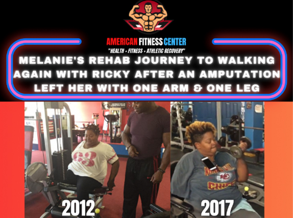 Amputee Rehabilitation & Fitness Mobility Program in Atlanta, GA - American Fitness Center